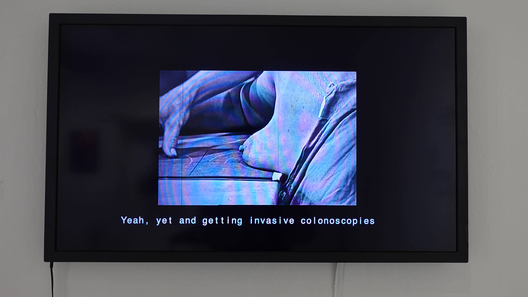 AE Gallery Image Slide